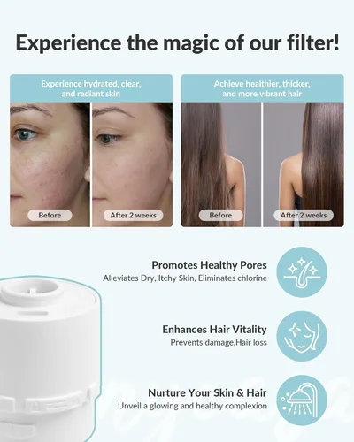 Miniatura 4 de SANYCASA Cabezal de Ducha Filtrado para Agua Dura, Elimina el Cloro y Metales Pesados, Filtro KDF-55 para Cabello y Piel Más Saludables, Protege