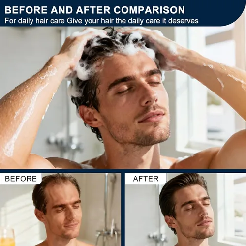 Miniatura 4 de Champú activador de raíces para hombres y mujeres, champú anti pérdida de cabello y crecimiento del cabello para hombres con ingredientes herbarios