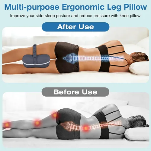 Miniatura 5 de SereneCloud Knee Pillow for Side Sleepers, Memory Foam Knee Pillow, Leg Pillows for Sciatica, Back, Hip, Knee & Ankle Pain Relief
