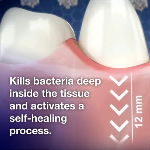 Miniatura 5 de Emmi-dent Cepillo de dientes eléctrico Oral Waver con tecnología 100% de ultrasonido, vibración suave y pasta de dientes nano-burbuja. Ideal