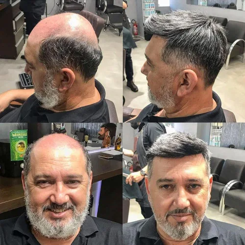 SIMBEAUTY Cabello humano súper natural para hombre, estilo libre de tupé, 10 x 8 pulgadas, sistemas de reemplazo de cabello para hombres (#1b40,