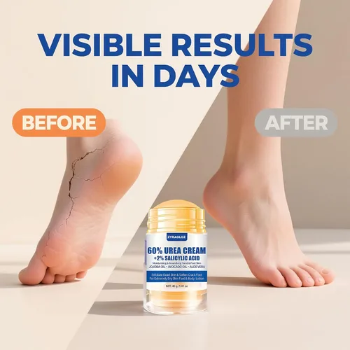 Miniatura 4 de Crema de Urea Stick 60% más Ácido Salicílico 2%, Crema de Pies de Urea de Fuerza Máxima para Talones Secos y Agrietados, Removedor de Callos