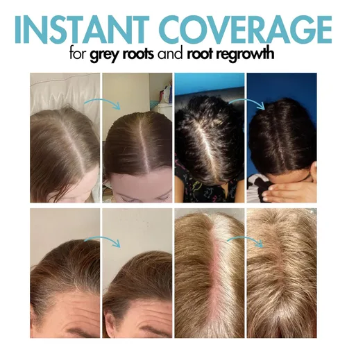 Miniatura 3 de Hair Genetics Cubre las raíces de tus canas, oculta las raíces de tus canas, nueva tecnología de polvo mineral de aspecto natural Resultados