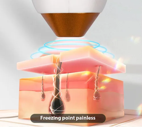 Miniatura 4 de 2025 La última máquina de depilación profesional con mango de hielo sin dolor permanente dispositivo de depilación 6BAR