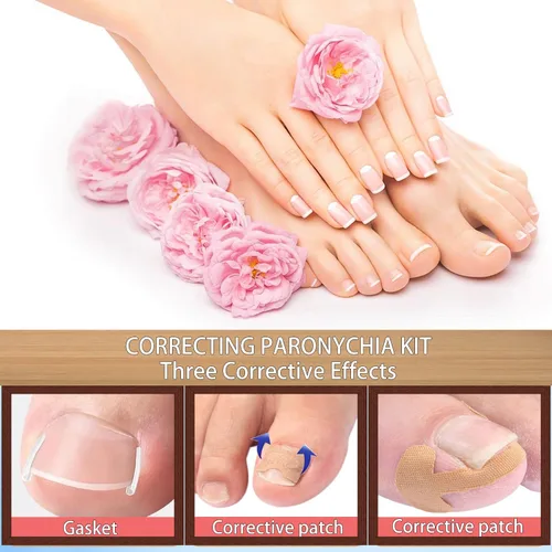 Miniatura 5 de Corrector profesional de uñas encarnadas para un alivio rápido con tiras transpirables de uñas encarnadas, herramientas de pedicura de acero