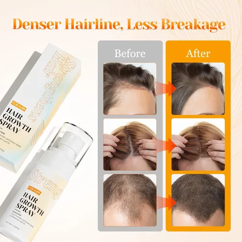 Miniatura 6 de Spray para el crecimiento del cabello para mujeres y hombres, suero para el crecimiento del cabello con aceite de romero y biotina, ayuda a prevenir