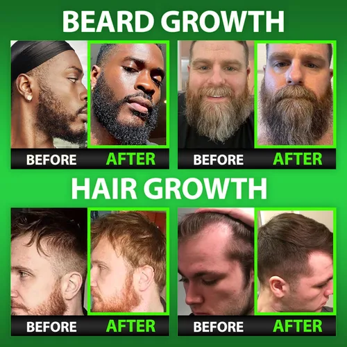 Miniatura 2 de Best Beard Stuff - Vitaminas para el crecimiento de la barba, gomitas de biotina para el crecimiento de la barba y el cabello, máxima fuerza