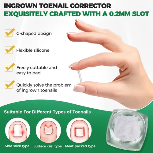 Miniatura 3 de Kit de eliminación de uñas encarnadas, tiras alisadoras de uñas sin dolor, 60 piezas, levantador de uñas y tijeras pequeñas, juego de corrector