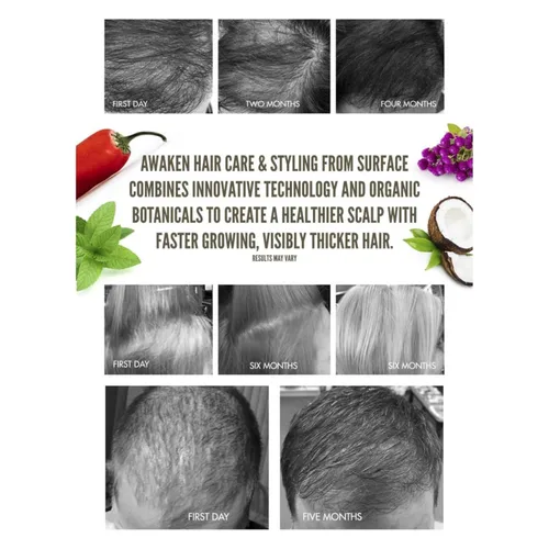 Miniatura 4 de Surface Acondicionador terapéutico Hair Awaken
