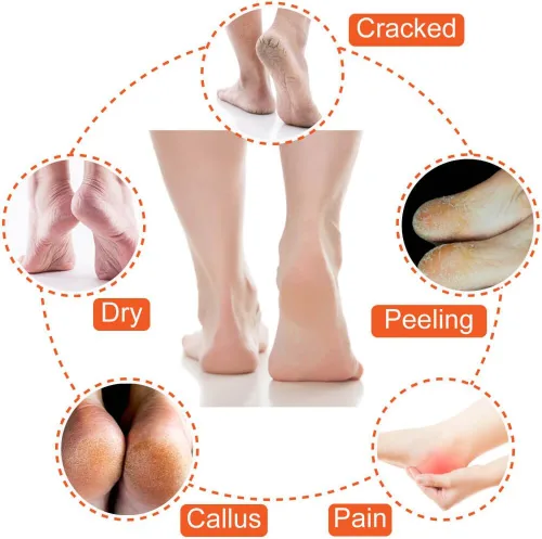 Miniatura 6 de Selizo 5 pares de calcetines hidratantes para el talón de gel, calcetines de punta abierta para tacones secos y agrietados, 5