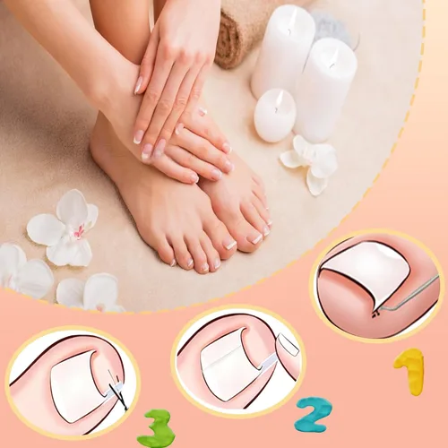 Miniatura 3 de Kit corrector de uñas encarnadas con tiras de corrección flexibles y cinta – Juego de herramientas profesionales de pedicura en el hogar