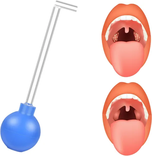 Kit de aspiradora para eliminar piedras amígdalas, limpiador de estilo manual, removedor de piedras amígdalas, apto para limpieza oral y cuidado