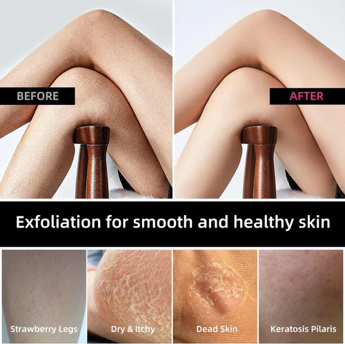 Miniatura 4 de Exfoliante profundo para la espalda, exfoliante de espalda para baño y ducha, herramienta exfoliante corporal, cuidado de la piel para mujeres