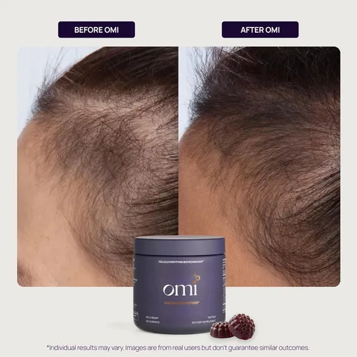 Miniatura 6 de OMI - Peptides for Hair Growth, Gummies for Women with Patented Follicle Fortifying Biotechnology, Now in Delicious Wild Berry Flavor