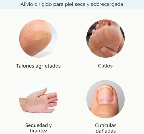 Miniatura 4 de Epielle Mascarillas reparadoras intensivas para manos y pies, restauran e hidratan la piel seca y agrietada, regalos de cuidado personal para Guantes