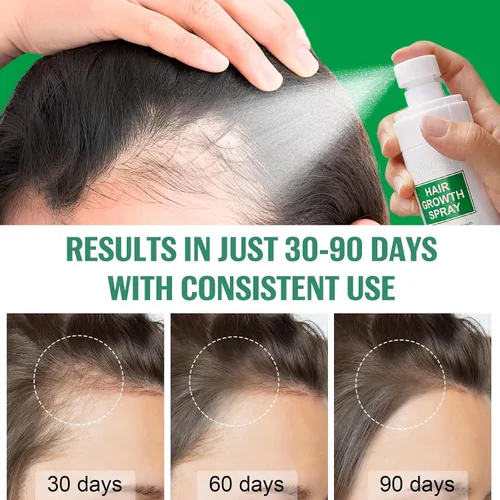 Miniatura 7 de Spray de suero para el crecimiento del cabello, spray natural para el crecimiento del cabello con biotina, batana, romero y aceite de ricino