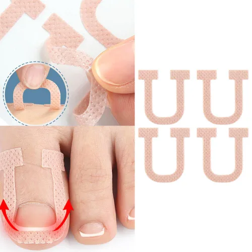 Miniatura 6 de Paquete de 40 parches correctores de uñas encarnadas en forma de U, correctoras de uñas de los pies, parches de corrección, vendajes para alivio