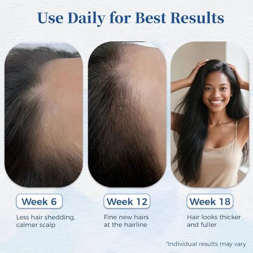 Miniatura 6 de Hair Growth Serum Roll On with Rosemary，Helps Support Thicker, Fuller Hair Appearance，Clean, Non-Greasy Hair Loss Support for Men & Women，0.84 Fl Oz