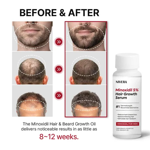 Miniatura 2 de NIVELA 5% de minoxidil para el crecimiento del cabello para hombres: 3 botellas de 2.0 fl oz Kit de crecimiento de barba extra fuerte - Suero