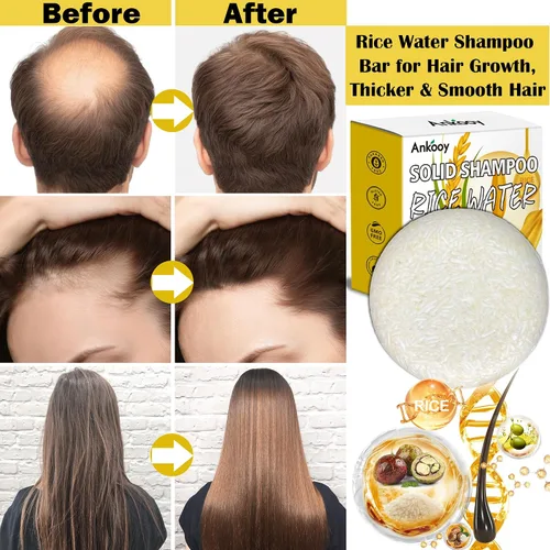 Miniatura 4 de ANKOOY Paquete de 2 barras de champú de agua de arroz, barras de champú de arroz para el crecimiento del cabello, champú para cabello seco, jabón