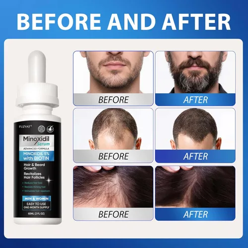 Miniatura 4 de 5% de minoxidil para hombres, minoxidil para mujeres, tratamiento para el crecimiento del cabello, suero de crecimiento de barba, enriquecido