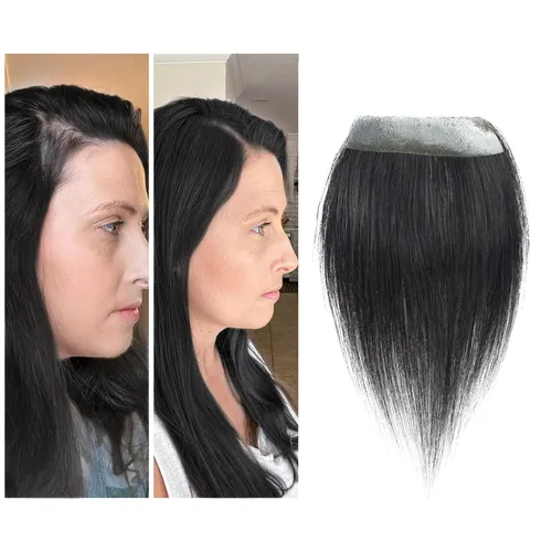 Miniatura 33 de Reemplazo de cabello humano con cicatrices, quemaduras accidentales sin vello para hombres y mujeres, pérdida de línea de cabello, cinta recta