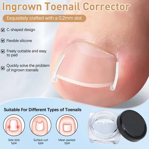 Miniatura 6 de Juego de corrector profesional de uñas encarnadas con tiras correctoras, kit de eliminación de uñas encarnadas, juego de herramientas de pedicura