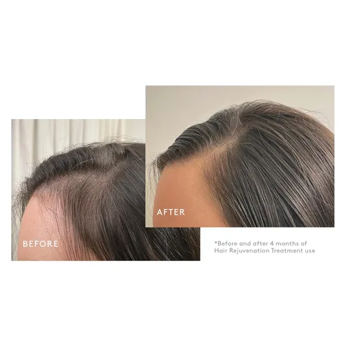 Miniatura 6 de Virtue Flourish - Paquete de tratamiento de champú, acondicionador y refuerzo de densidad para cabello adelgazante para mujeres, régimen capilar