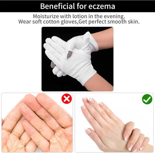 Miniatura 5 de Sibba 2 pares de guantes hidratantes con pantalla táctil, guantes hidratantes de algodón blanco, para uso nocturno, tratamiento para ectima, manos