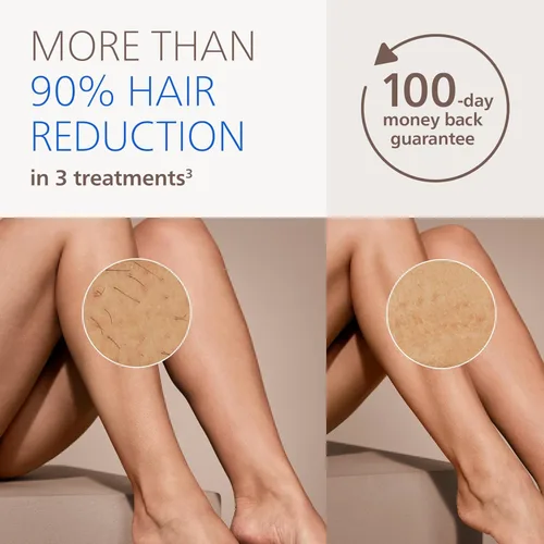 Miniatura 3 de Philips Lumea 7000 Series Dispositivo de depilación IPL - Reducción láser permanente del vello para mujeres y hombres, fácil y cómodo de usar