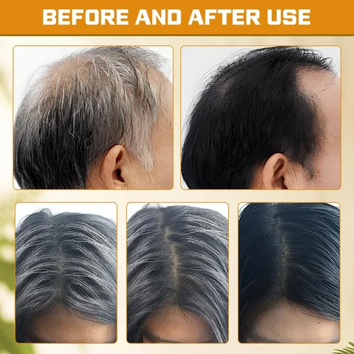 Miniatura 5 de Atsy Jabón en barra de cabello gris, jabón negro natural para cobertura de cabello gris, barra de champú oscurecimiento con ginseng y sésamo negro