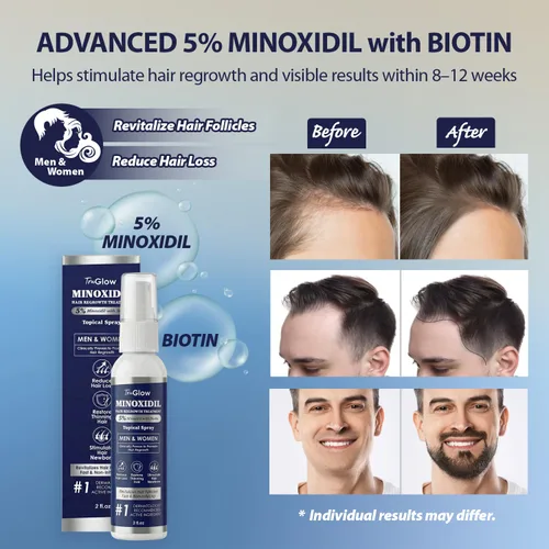 Miniatura 4 de TruGlow - Spray de tratamiento de crecimiento del cabello de minoxidil al 5% para hombres y mujeres con cabello delgado, solución tópica