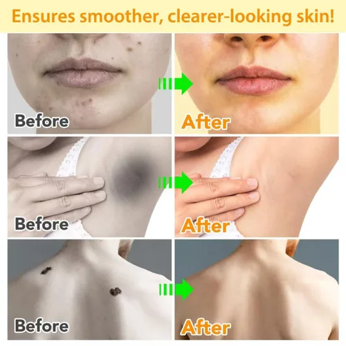 Miniatura 9 de Bee Venom Cream, nueva crema reparadora de tratamiento de la piel para todas las partes del cuerpo, gel de miel suave profesional para todo