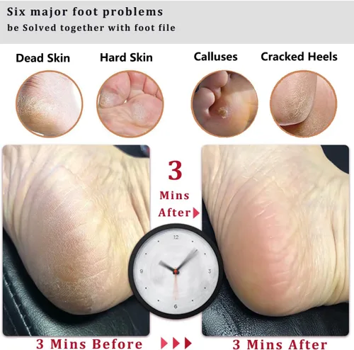 Miniatura 4 de Kinepi - Lima para pies removedor de callos, piedra pómez para pies húmeda y seca Wooden pedicure foot rasp helps smooth dead skin, cracked heels