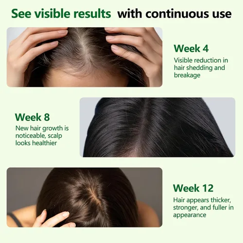 Miniatura 5 de Suero roll-on para el crecimiento del cabello, ayuda a reducir la caída del cabello y promueve un cabello más grueso y de aspecto más completo