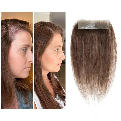 Miniatura 49 de Reemplazo de cabello humano con cicatrices, quemaduras accidentales sin vello para hombres y mujeres, pérdida de línea de cabello, cinta recta