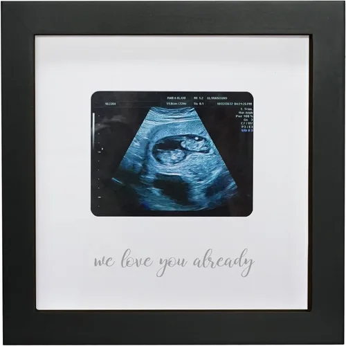 Miniatura 7 de Sonogram - Marco de fotos para abuela, marco de fotos de ultrasonido, anuncio de embarazo para abuela, ideas de anuncio de bebé, marco de fotos
