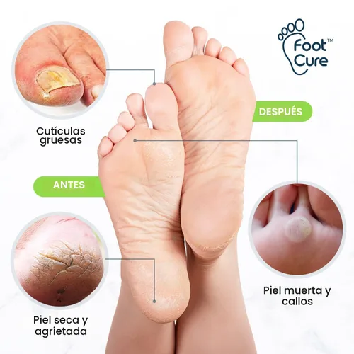 Miniatura 8 de FOOT CURE Juego de pedicura exfoliante y removedor de callos – Kit de cuidado que incluye lima para piel muerta, sales de remojo de aceite de árbol
