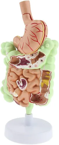 Miniatura 6 de KESOTO Modelo de Patología Gastrointestinal Humana Modelo Coronal Gástrico del Tracto Digestivo para Estudiantes Escolares Aprendizaje