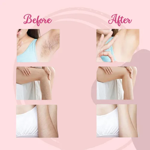 Miniatura 4 de Borrador de pelo de cristal, depiladora para mujeres y hombres, herramienta reutilizable para depilación y exfoliación, borrador de vello facial