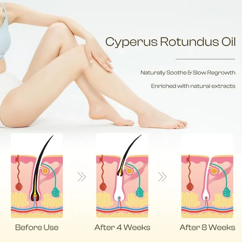 Miniatura 4 de Aceite Cyperus Rotundus para depilación: reduce el crecimiento no deseado del cabello, ralentiza el nuevo crecimiento, calma la piel y encoge