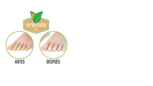 Miniatura 5 de Solución de reparación de uñas Oriundo Life 0.5oz - Paquete de 2