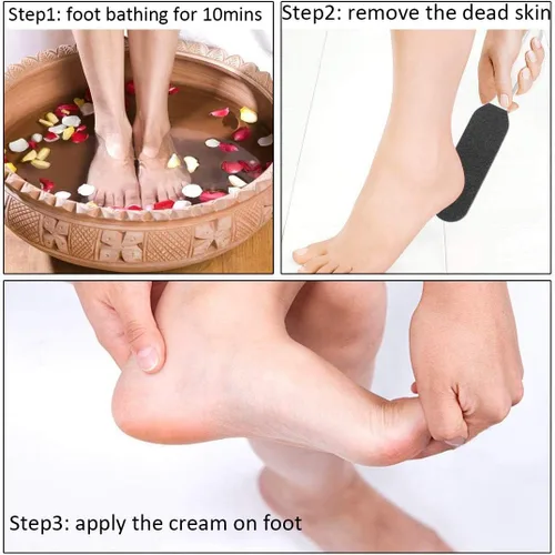 Miniatura 6 de Lima de pedicura profesional para pies – Reutilizable de acero inoxidable agrietado callos de la piel removedor de callos