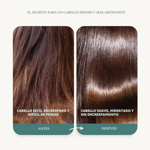 Miniatura 3 de Edenika Botanicals Juego de champú y acondicionador de aceite de romero con biotina para cabello fino y contra la caída del cabello, fórmula