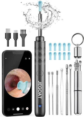 Cámara con herramienta de eliminación de cera de oído, limpiador de oídos con cámara, kit de limpieza de oídos 1296P HD, 6 luces LED y 11 púas para