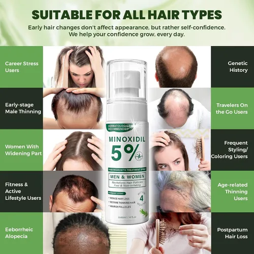 Miniatura 7 de Spray para el crecimiento del cabello de minoxidil al 5% para hombres y mujeres con aroma a romero, paquete de 2 unidades de 2.1 onzas líquidas