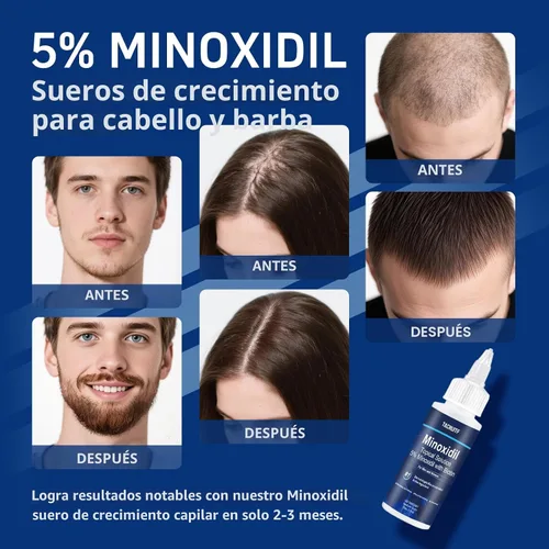 Miniatura 3 de Paquete de 6 minoxidil al 5% con biotina, tratamiento para el crecimiento del cabello, minoxidil para el crecimiento del cabello y la barba