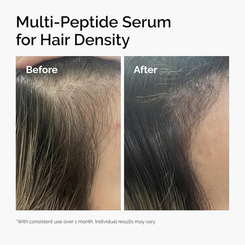 Miniatura 7 de The Ordinary Multi-Peptide Serum for Hair Density, Peptide-Powered Formula for Thicker, Fuller Looking Hair
