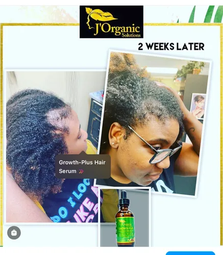 Miniatura 5 de J'Organic Solutions Kit de crecimiento de cabello súper saludable para adultos, hidratante de crecimiento, acondicionador profundo, sellador