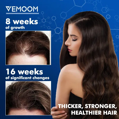 Miniatura 5 de Spray para el crecimiento del cabello de minoxidil al 5% para mujeres y hombres, tratamiento eficaz contra la pérdida de cabello para el nuevo